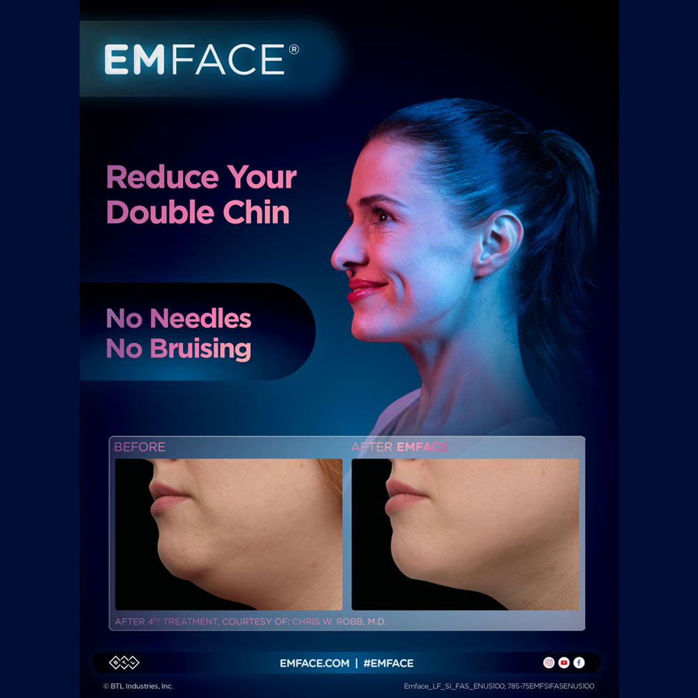 EMFACE-Brochure-2--Full-Life-Wellness-Center-Nashville, TN